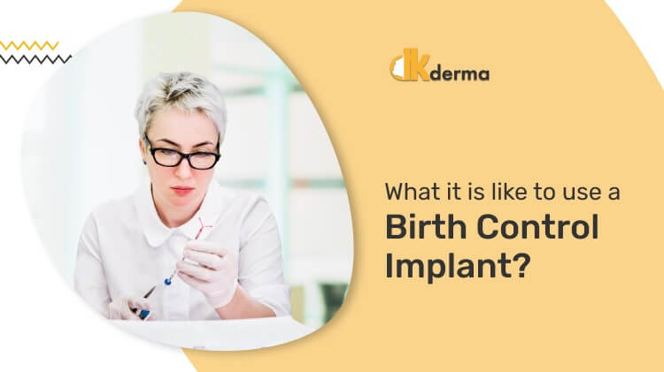 What it is like to use a birth control implant?