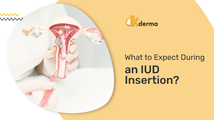 What to Expect During an IUD Insertion?