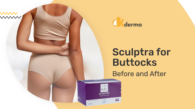 Sculptra for buttocks before and after