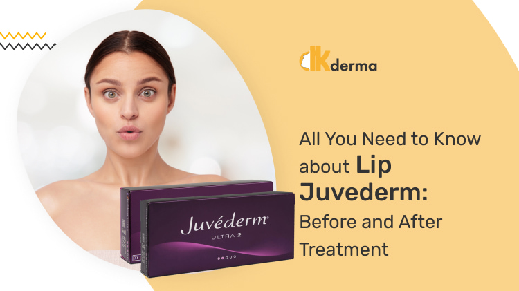 All You Need to Know about Lip Juvederm Before and After Treatment