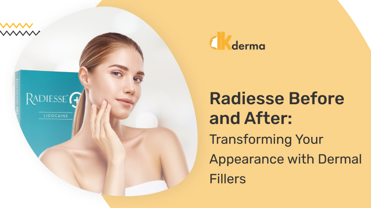 Radiesse Before and After Transforming Your Appearance with Dermal Fillers