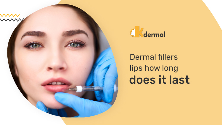Dermal Fillers for Lips How Long Do They Last?
