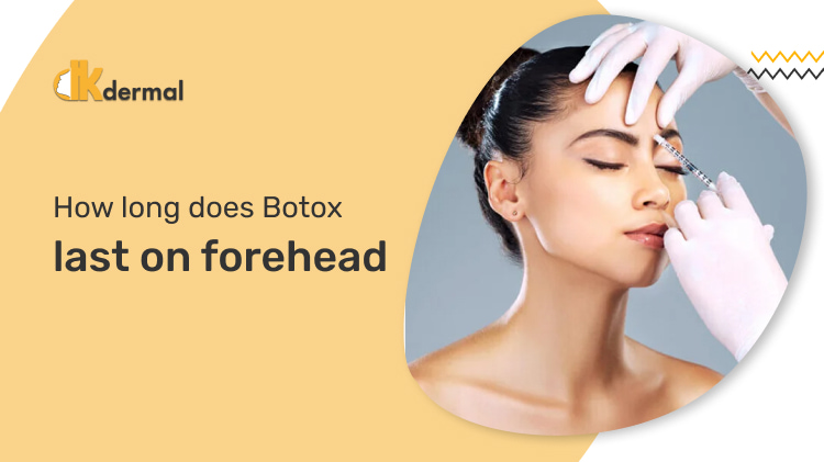 how long does botox last on forehead