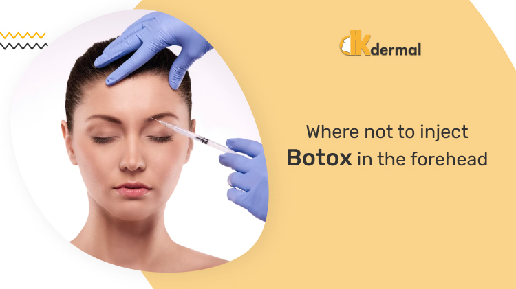 Where Not to Inject Botox Forehead?