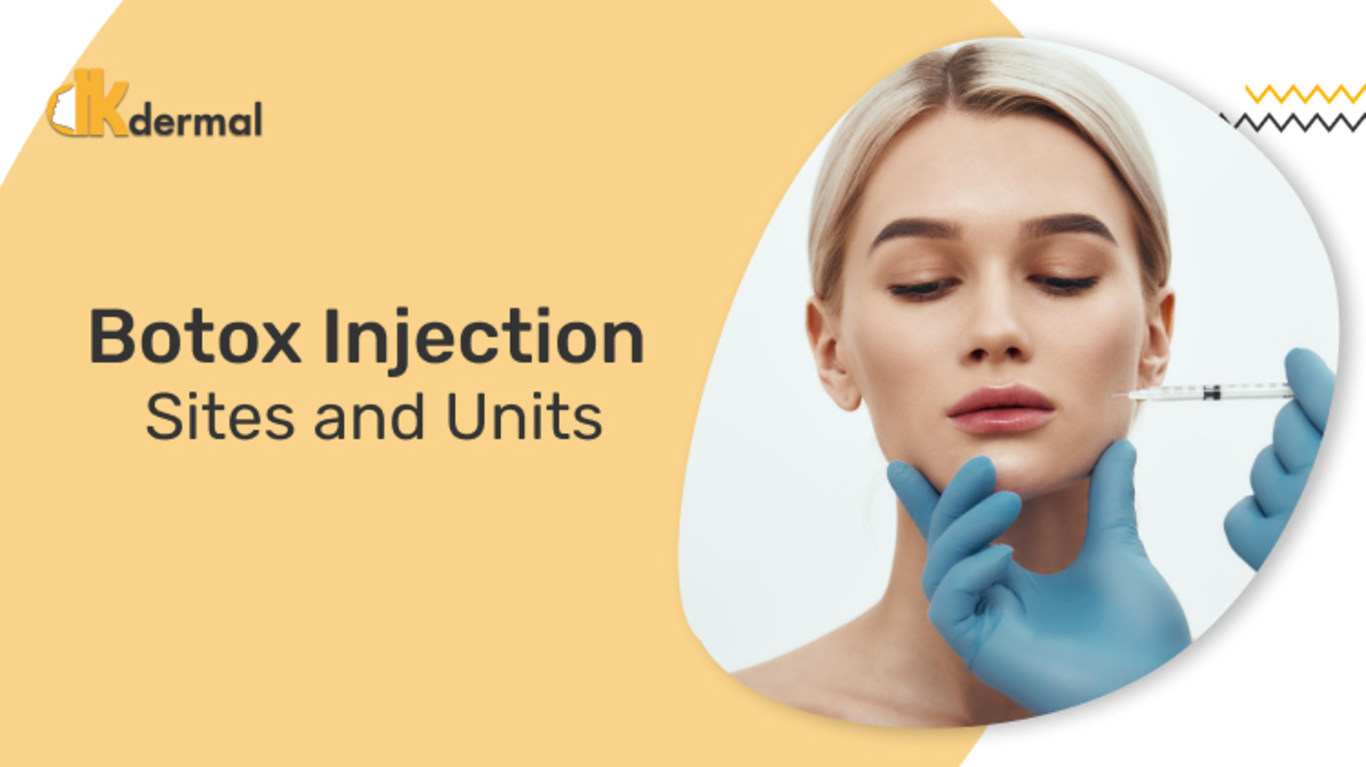 Botox Injection Sites and Units