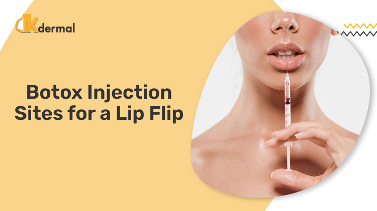 Botox Injection Sites for a Lip Flip