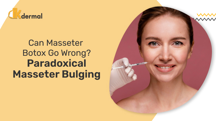 Can Masseter Botox Go Wrong? Paradoxical Masseter Bulging