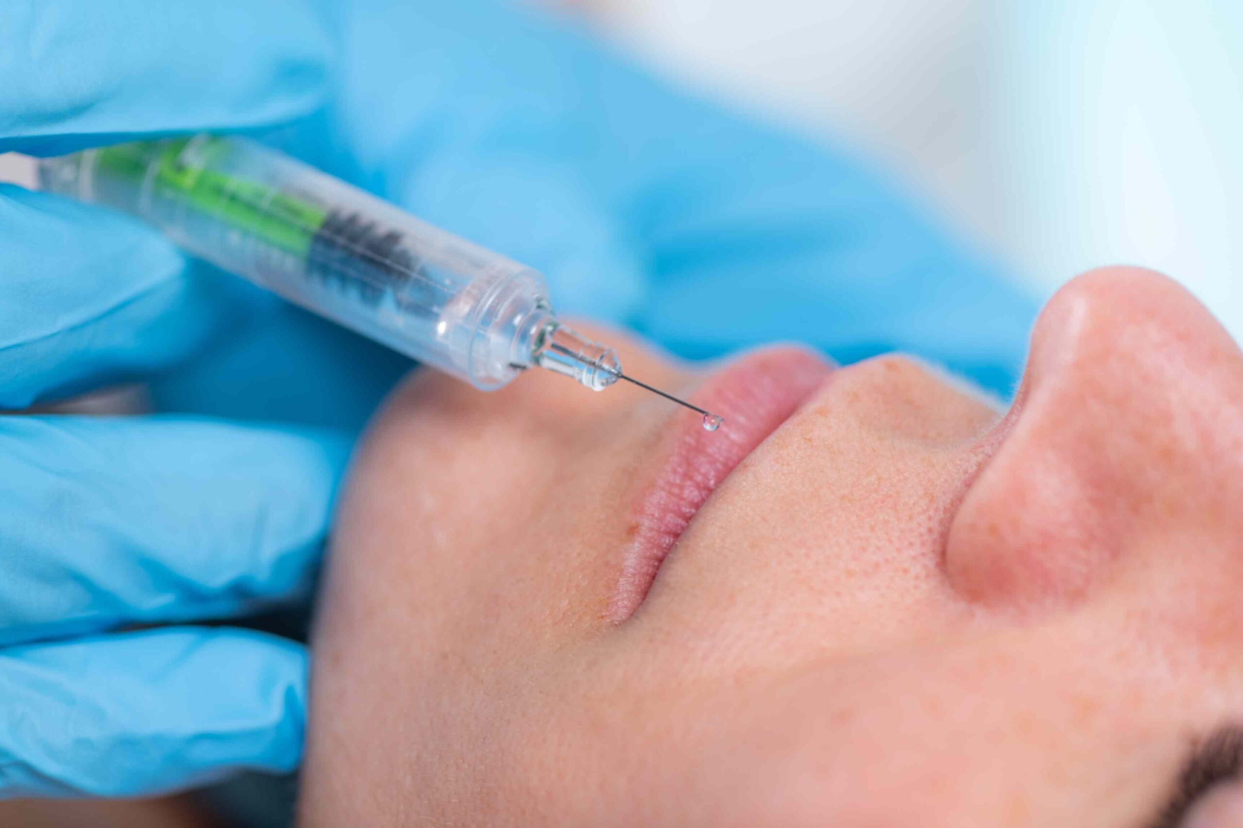 Restylane Kysse vs Juvederm Ultra: Which Is Better