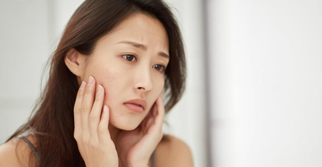 Skin Fatigue: Signs that Your Skin is Feeling the Stress