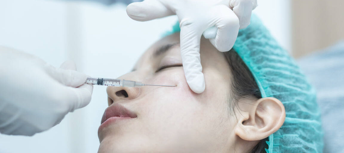 Restylane Before and After Marionette Lines