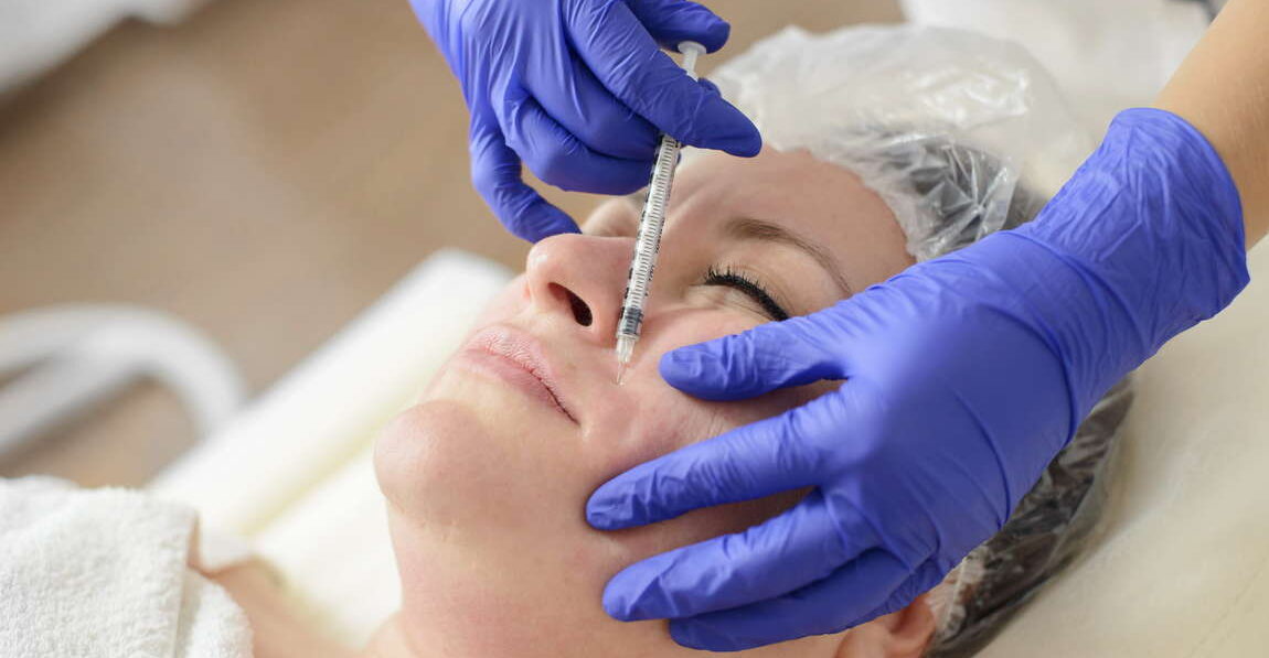 Juvederm Vollure Before and After: Results You Can Expect