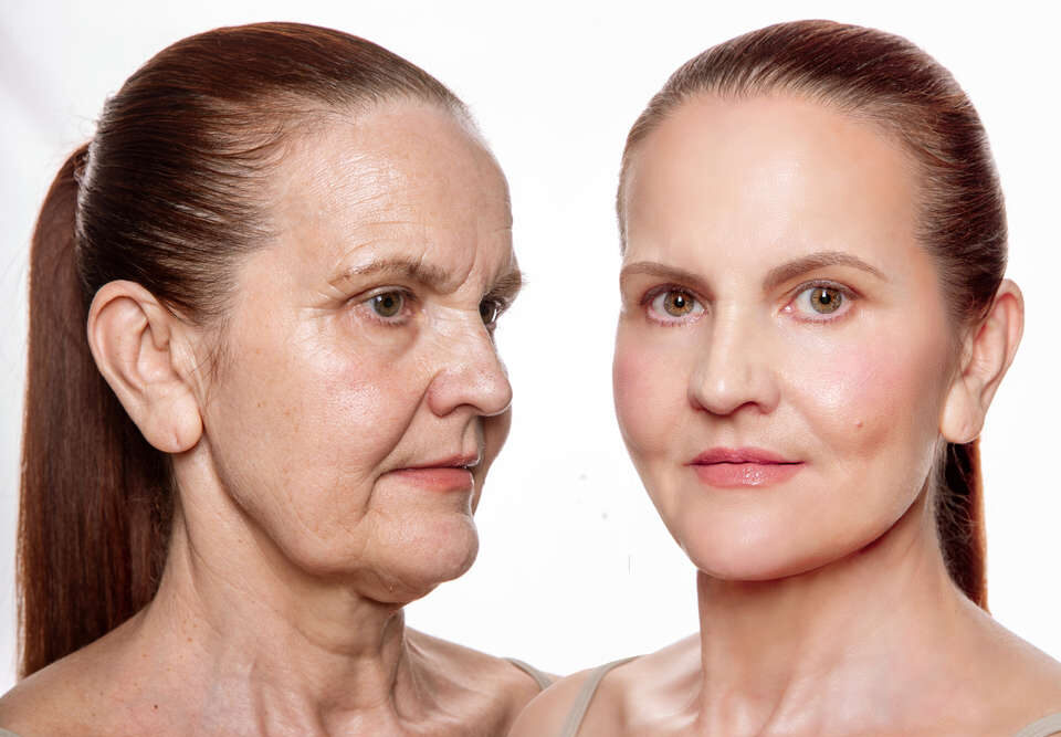 How Facial Anatomy Changes with Age