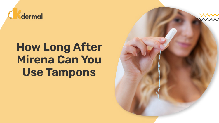 How Long After Mirena Can You Use Tampons