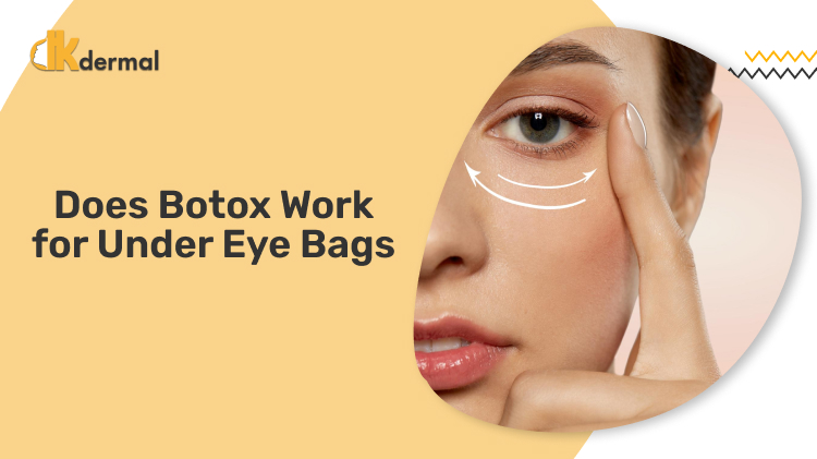 Does Botox Work for Under-Eye Bags