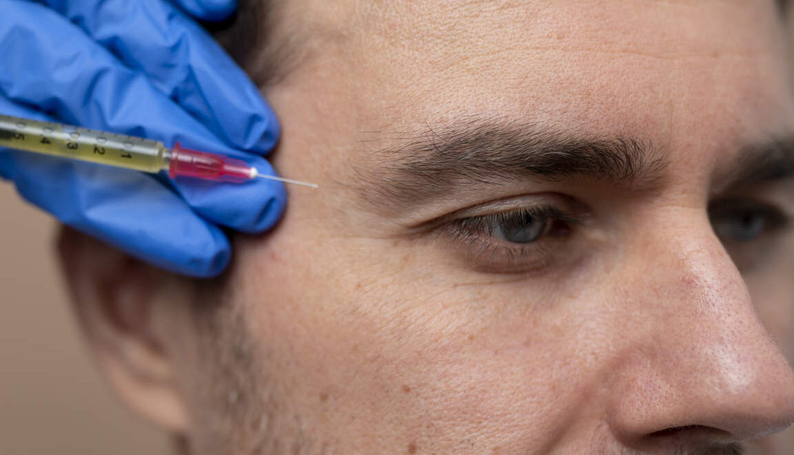 Side Effects of Migraine Botox and Long Term Safety